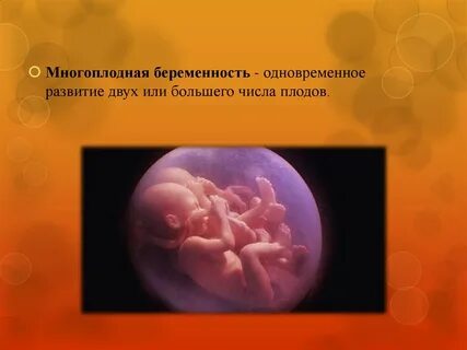Многоплодная беременность