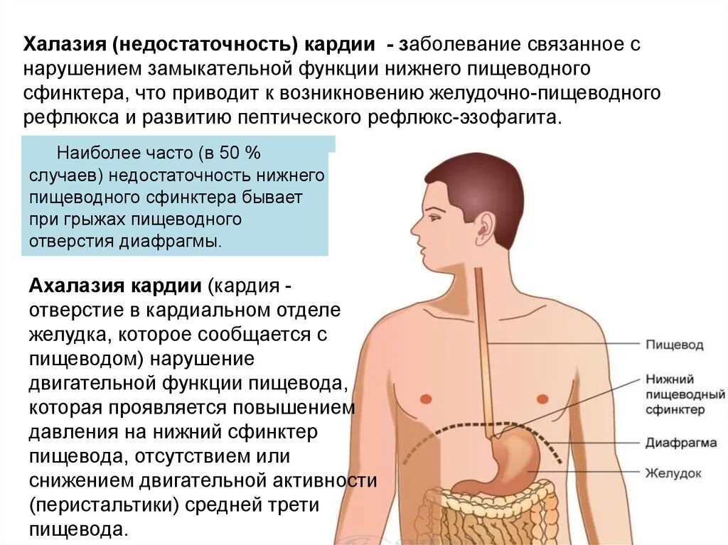 Болит пищевод и желудок