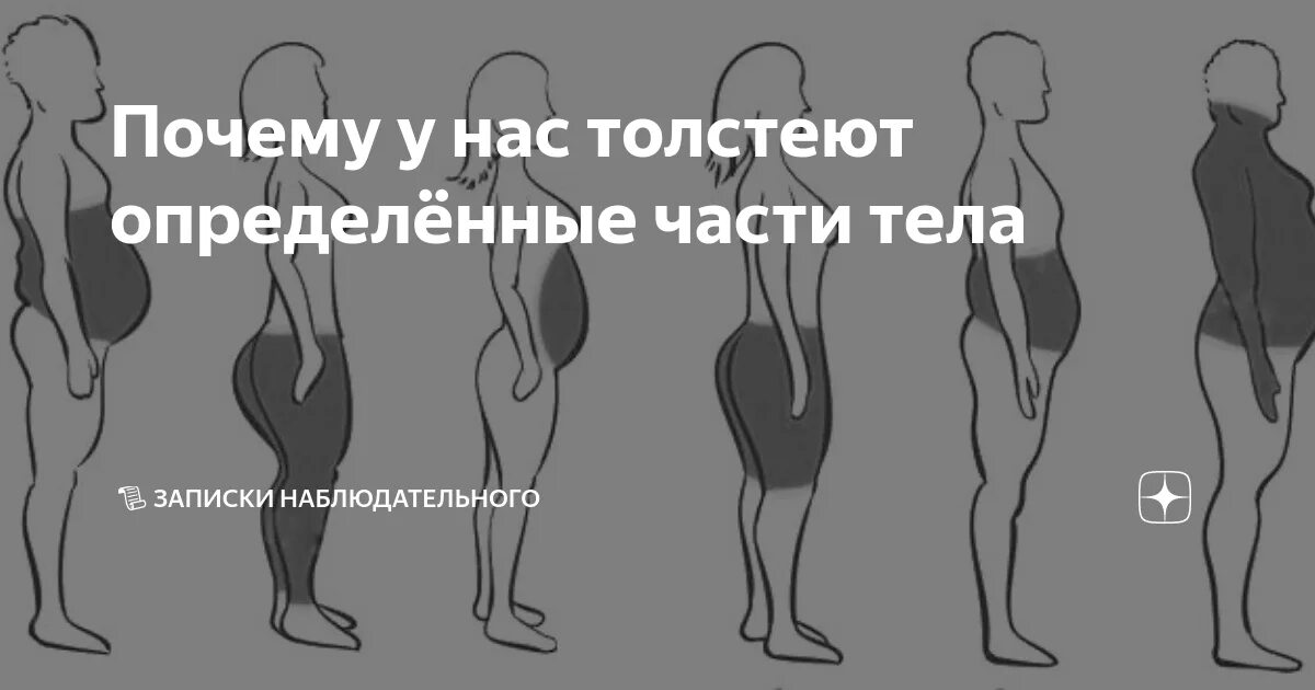 триггерные точки мышц таза. болит мышца бедра сбоку при ходьбе. болит бедро при отведении ноги назад. симптомы поражения корешка s1. защемление нерва в бедре.