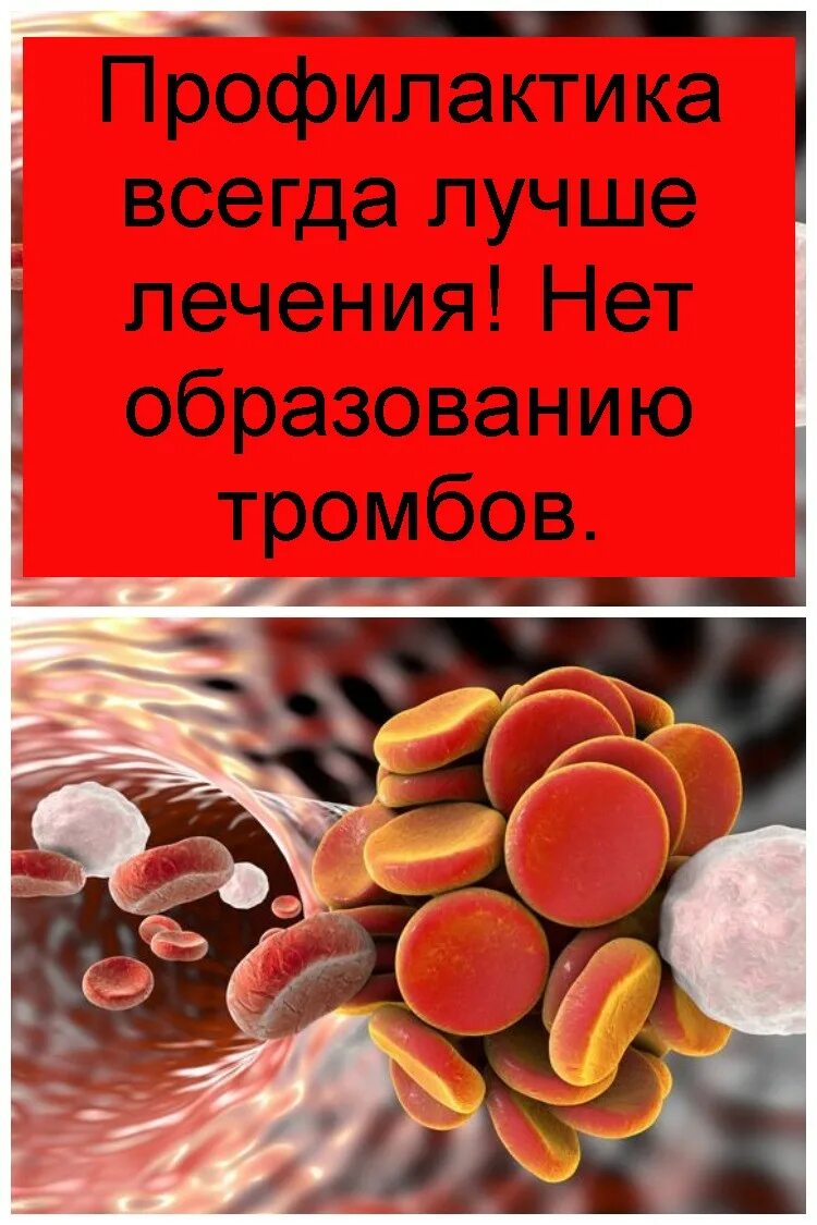 Что нужно есть чтобы не было тромбов. Профилактика образования тромбов. Профилактика тромбообразования. Профилактика тромбов в сосудах.