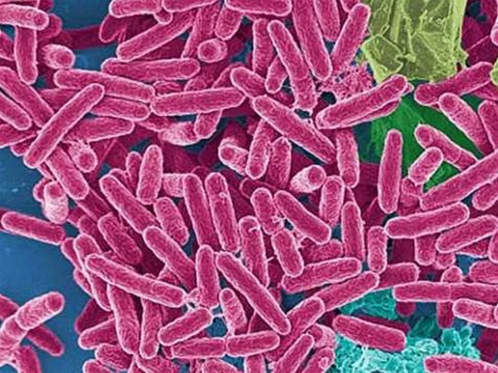 Pseudomonas spp что это