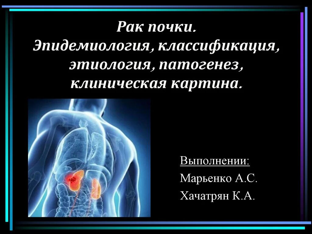 Опухоли почек этиология. Патогенез опухоли почки. Эпидемиология карцинома почки. Патогенез клиническая картина. Клинический рак почки