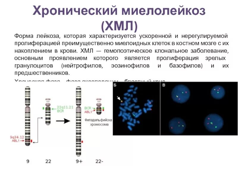 Тест нмо хронический миелолейкоз по утвержденным клиническим. Тест нмо хронический миелолейкоз по утвержденным клиническим