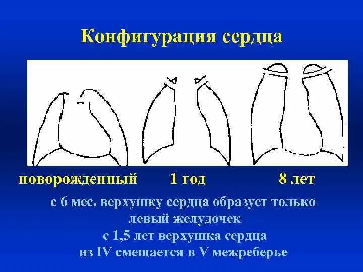 Конфигурации сердца. Конфигурация сердца. определение конфигурации сердца. патологические конфигурации сердца. нормальная конфигурация сердца схема.