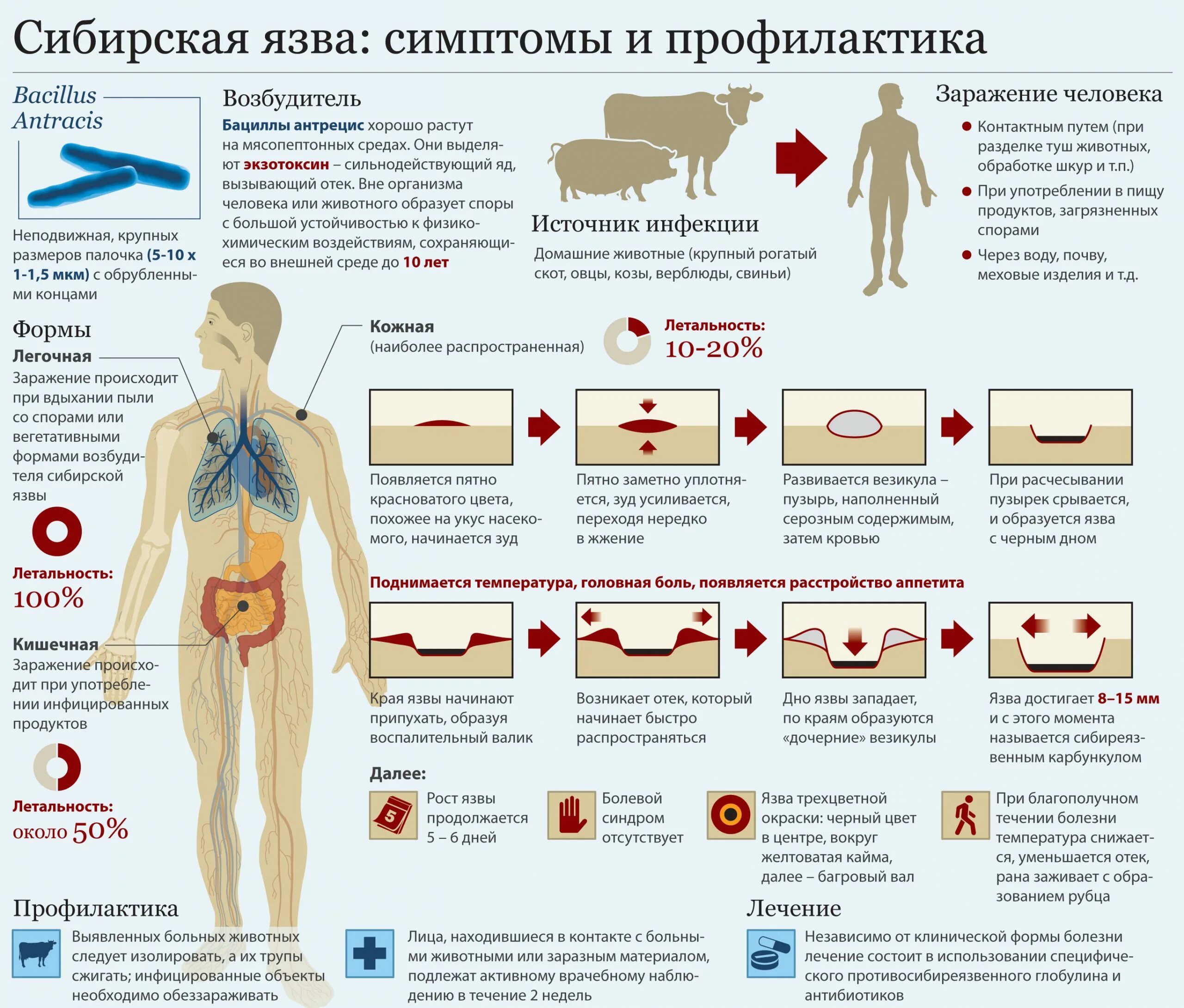 Холера сибирская язва