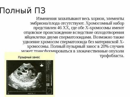 Хорион 9 недель