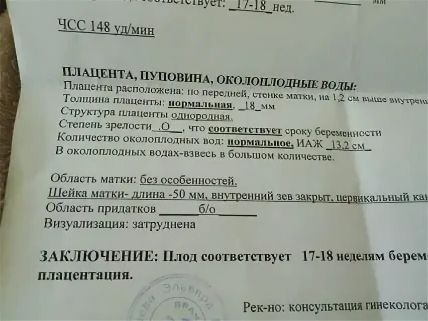 Взвесь в околоплодных Водах. Взвесь в околоплодных Водах по УЗИ. Гиперэхогенная взвесь в околоплодных Водах. Структура околоплодных вод. Околоплодные воды 20 недель