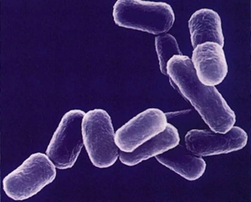 Clostridium spp. Кишечные инфекции ботулизм. Ботулизм микроб. Возбудитель ботулизма. Clostridium botulinum кишечная палочка.