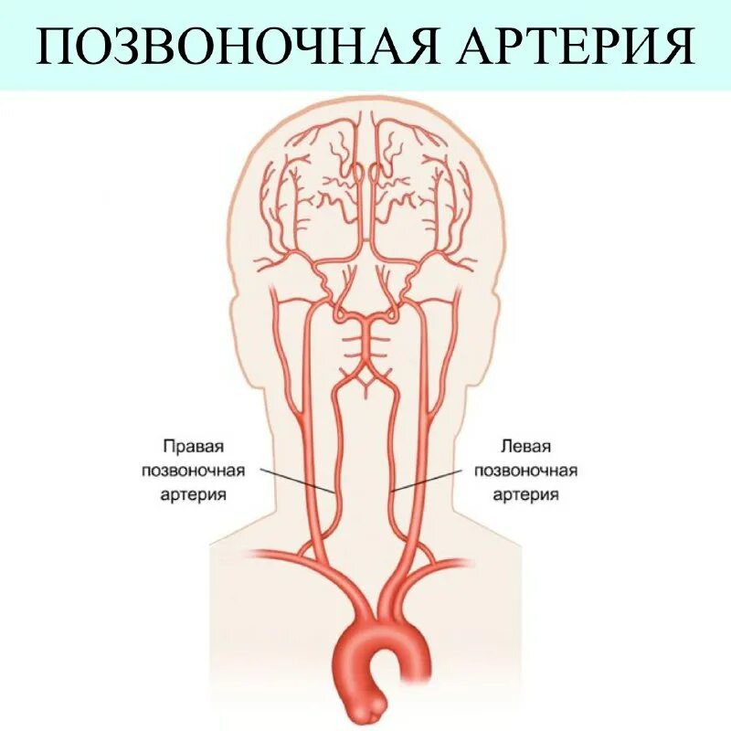 тест позвоночной артерии