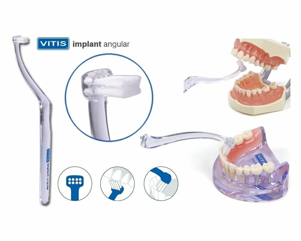 Как чистить монопучковой щеткой. Зубная щётка для протезов. Щетка для съемных зубных протезов. Зубная щетка для имплантов. Чистка зубов щеткой.