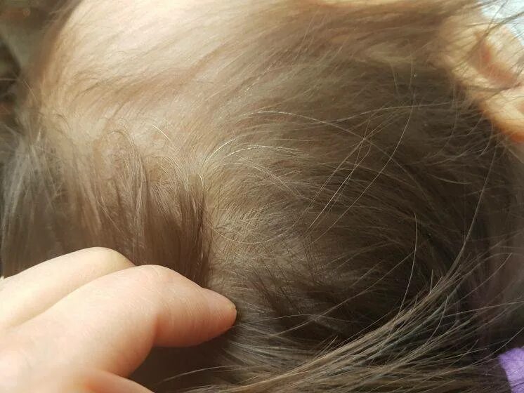 У ребенка седые волосы в год