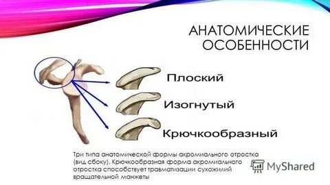 Импичмент синдром плечевого сустава