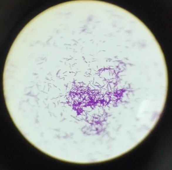 Бациллы в мазке. Бациллы сибирской язвы микроскопия. Bacillus anthracis Сибирская язва. Bacillus anthracis микроскопия. Сибиреязвенная бацилла микробиология.