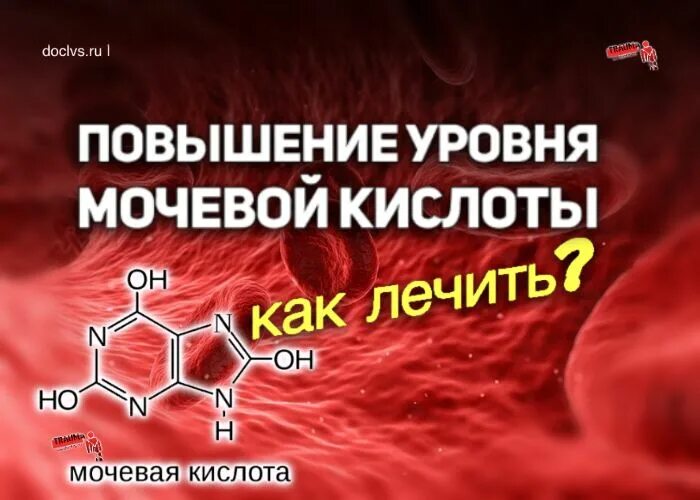 Что повышает уровень мочевой кислоты. Повышение мочевой кислоты. Причины повышения мочевой кислоты. Повышенная мочевая кислота у мужчин. Факторы вызывающие повышение мочевой кислоты.