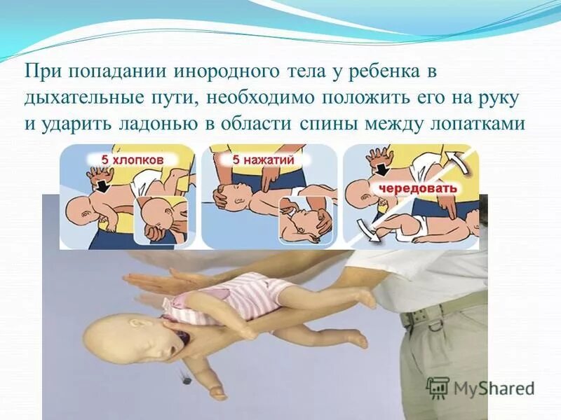 Инородное тело в дыхательных путях у ребенка. Извлечение инородного тела из дыхательных путей у детей. Помощь при инородном теле у детей. Оказание неотложной помощи при инородных телах. Аспирация инородного тела в дыхательные пути.