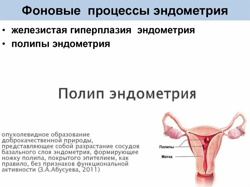 Полип эндометрия в матке что это такое