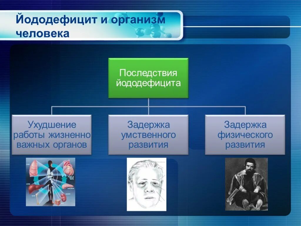 Недостаток йода может привести к развитию ответ. Осложнения йододефицита. Недостаток йода в организме человека. Профилактика недостатка йода в организме. Профилактика йода в организме человека.