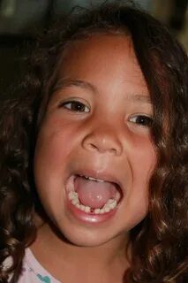 Foot tongue mouth