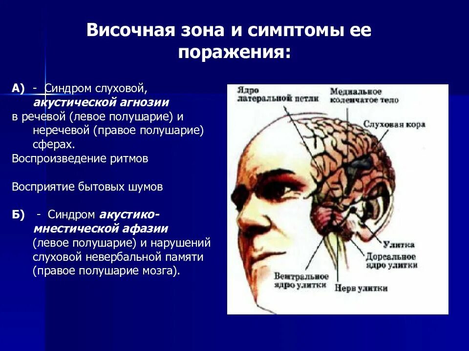 Симптомы поражения коры височной доли головного мозга. Синдром поражения височной доли головного мозга. Поражение левой височной доли. Слуховая зона в височной доле. Поражения корково мозга