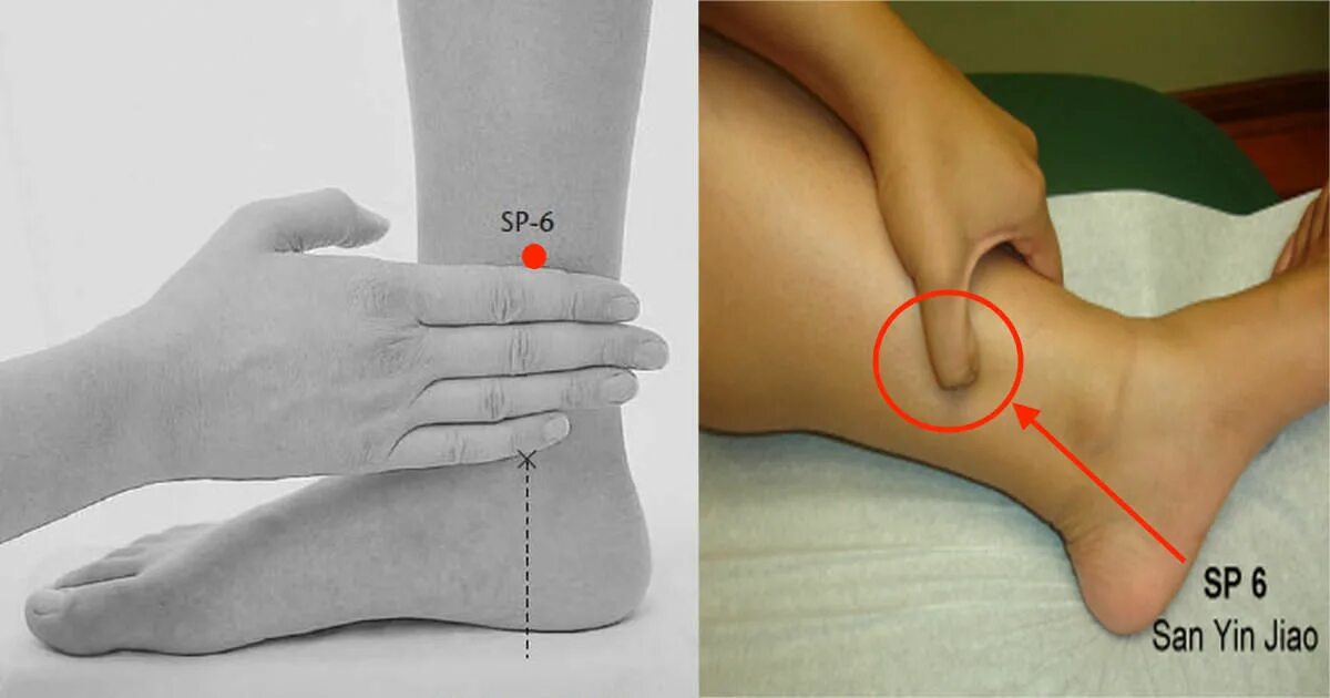 Фотографии 6 точки. Точки акупунктуры при отеках ног. Точки для снятия боли в ногах. Точечный массаж при менструационных болях. Точки на ногах для снятия отечности.