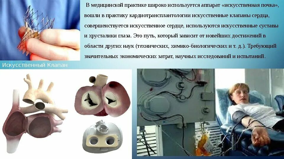 Проблемы создания искусственных органов для трансплантологии