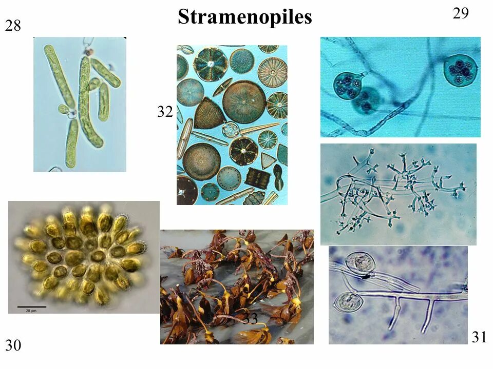 Страменопилы. Страменопилы одноклеточные. Жгутики страменопил. Трехчастные мастигонемы.