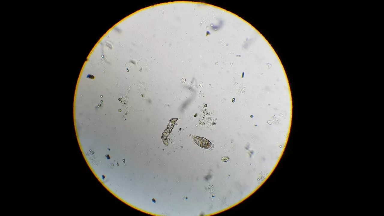Бактерии в питьевой воде. Водопроводная вода под микроскопом. Микроорганизмы в капле воды. Бактерии в воде под микроскопом. Микроорганизмы в капле воды под микроскопом.