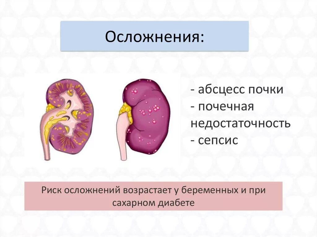 Карбункул почки макропрепарат. Абсцесс почки профилактика. Осложнения абсцесса почки. Осложнения на почки после