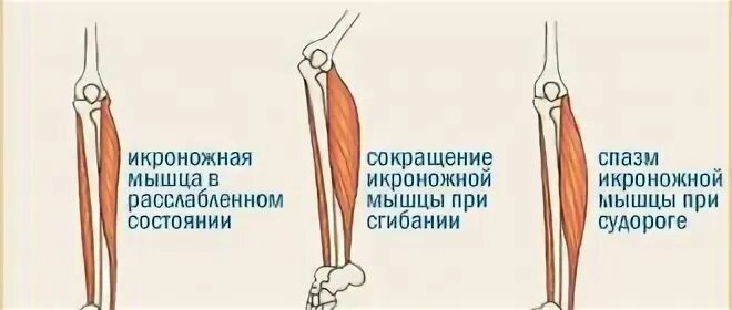 Сводит мышцы по всему телу причины