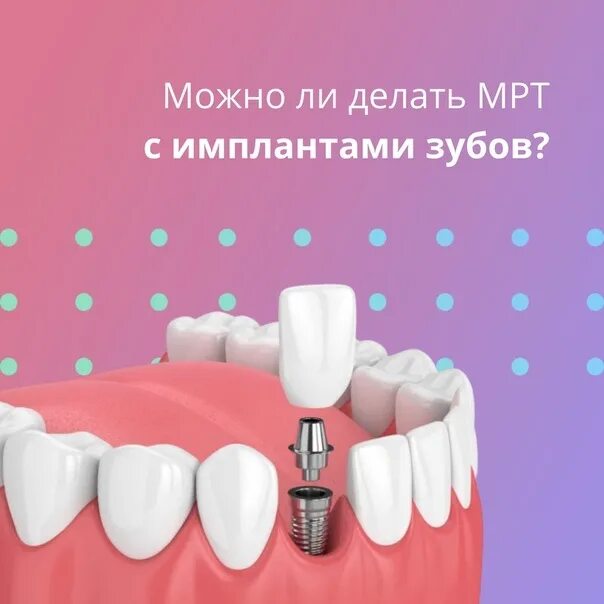 Импланты и мрт можно делать