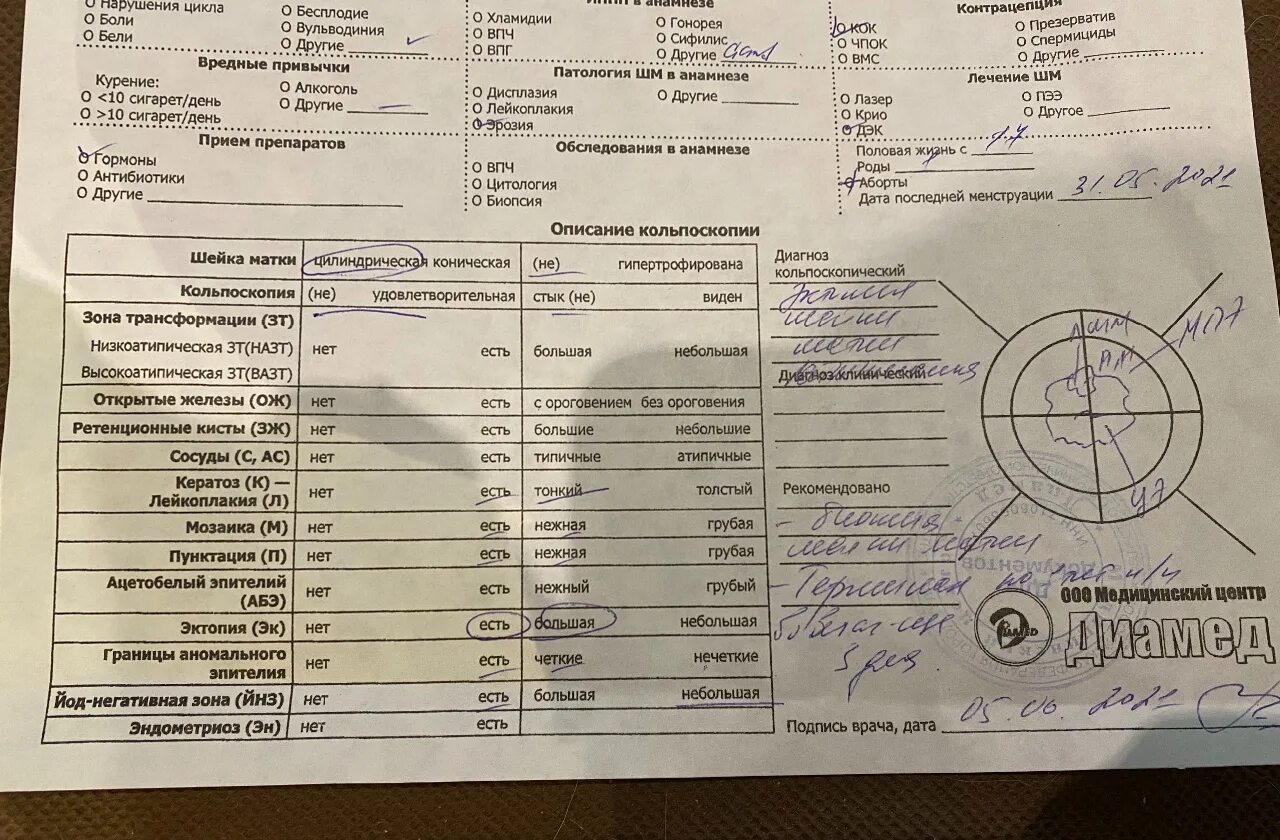 Кольпоскопия анализ. Протокол кольпоскопии. Диагноз кольпоскопии. Заключение кольпоскопии.