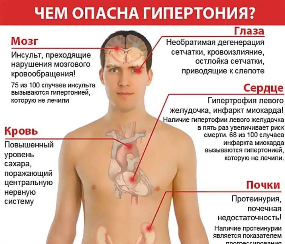 Сосудистый криз