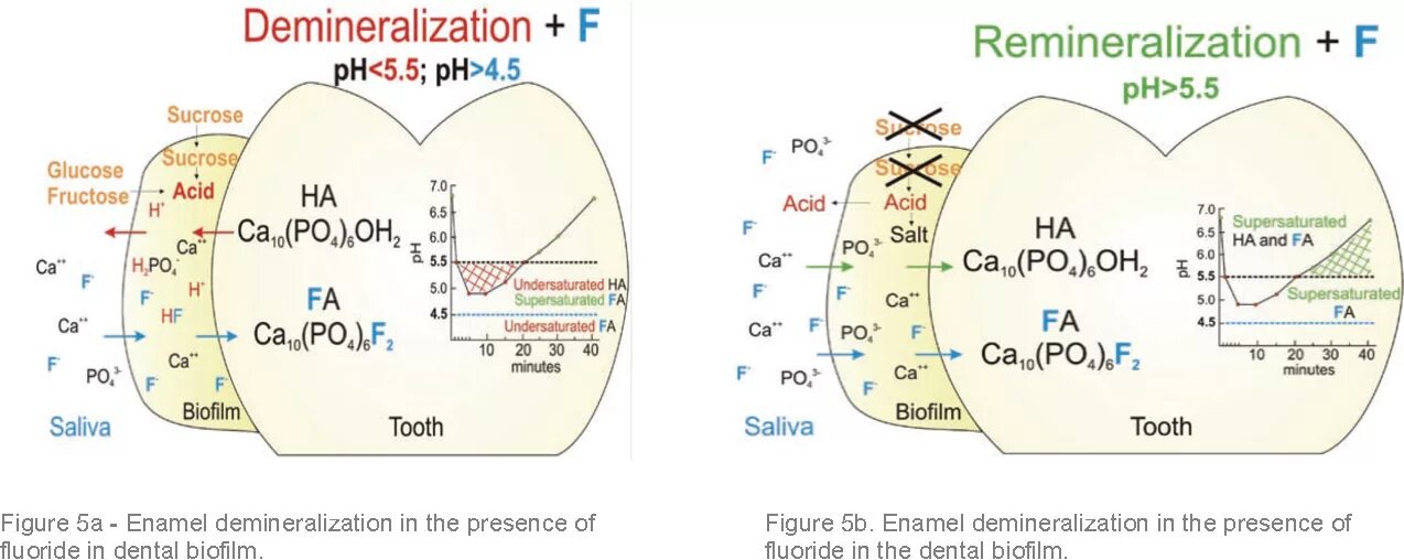 Биохимия зуба. Механизм деминерализации и реминерализации эмали. Схема реминерализации эмали. Процессы деминерализации и реминерализации зубной эмали. Процесс реминерализации зубов.