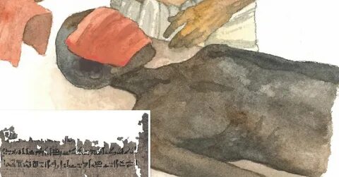 Подагра описывалась еще в древнем египте