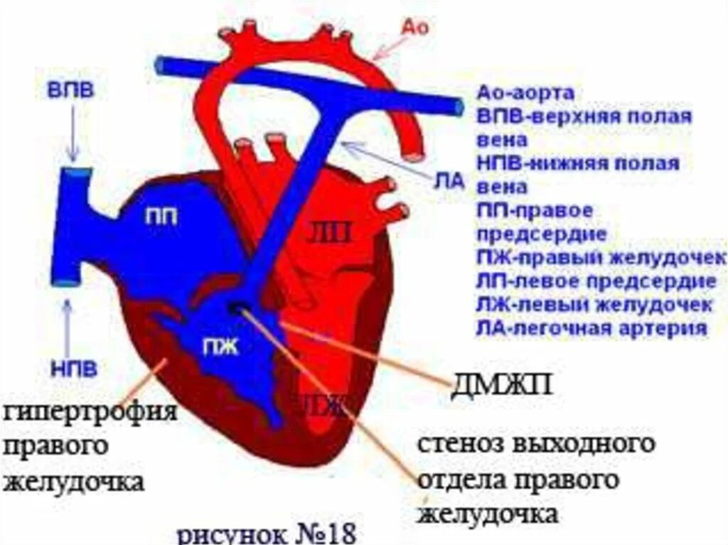 Какую функцию выполняет верхняя полая вена. Верхняя полая вена правое предсердие. левая верхняя легочная вена.