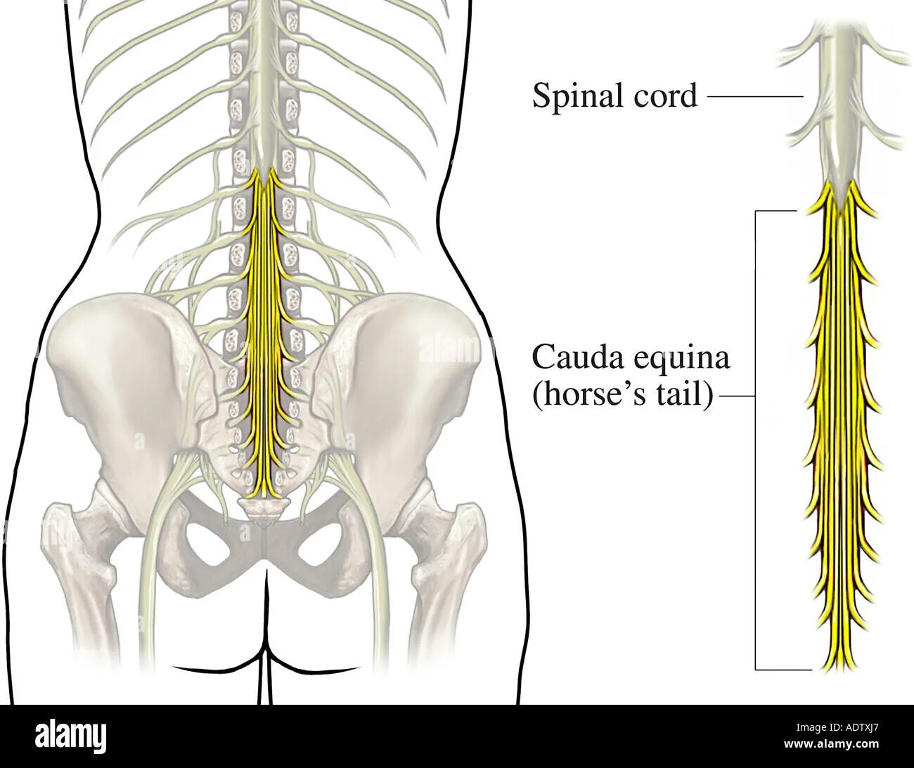 Пояснично-крестцовый отдел спинного мозга. Седалищный нерв и конский хвост. Конский хвост кауда эквина. Спинной мозг конский хвост седалищный нерв. Пояснично крестцовый отдел операция на позвоночнике