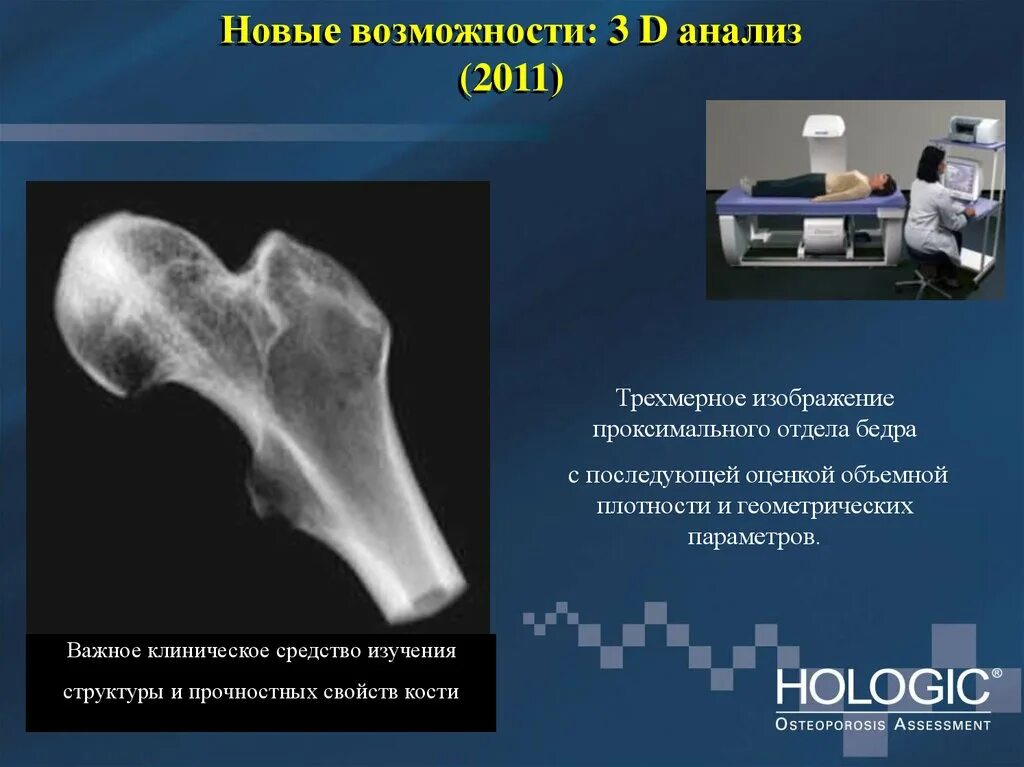 Денситометрия костей в москве где. Денситометрия костей остеопороз. денситометрия заключение. ультразвуковая денситометрия костей. денситометрия презентация.
