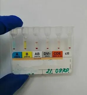 Антиэритроцитарные антитела анализ