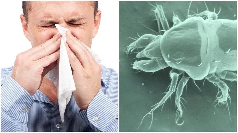 Аллергены клещей домашней пыли. Клещи домашней пыли. Пыль и клещи домашней пыли. Пылевой клещ. Микроклещи домашней пыли.