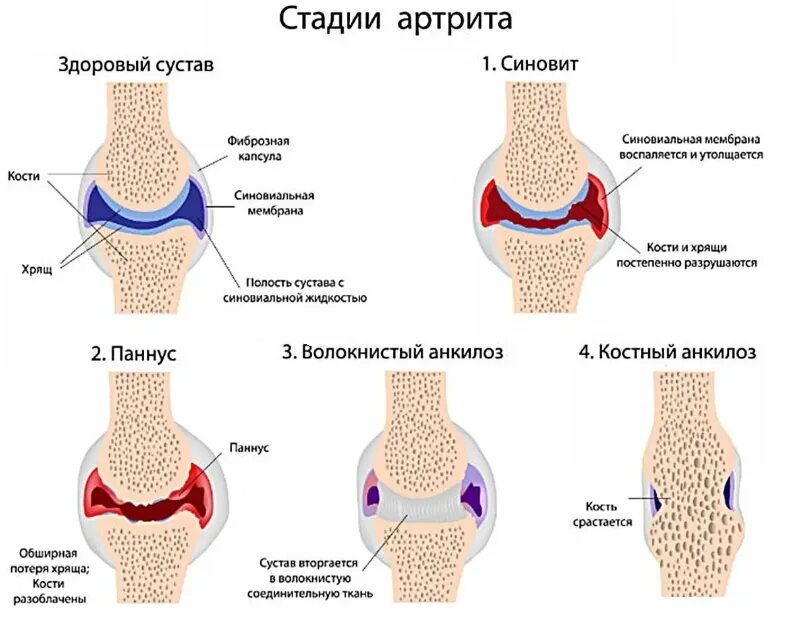Положения суставов