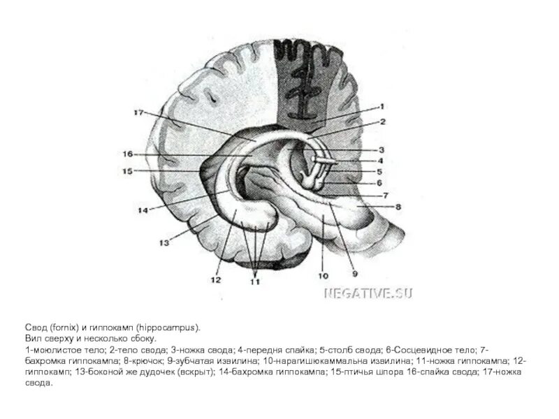 Спайки головного мозга. Строение свода головного мозга. Мозолистое тело свод передняя спайка анатомия. Свод Fornix. Столбы свода прозрачная перегородка. Свод головного мозга схема.