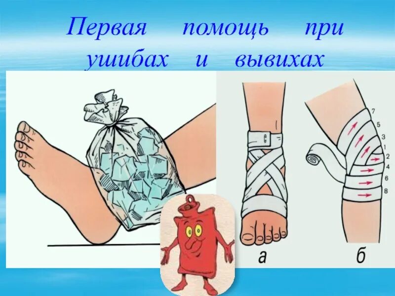 Первое помощь при ушибе. Первая помощь при ушибах. первая помощь при ушибах и вывихах. первая помощь при ушибах растяжениях связок вывихах.