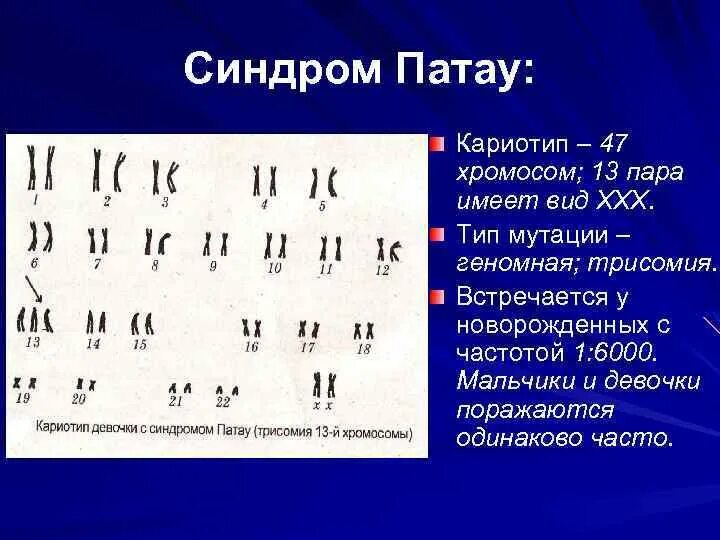 Кариограмма синдрома Эдвардса. Синдром Эдвардса кариотип. Кариотип больных с синдромом Патау. Синдром Патау трисомия 13.