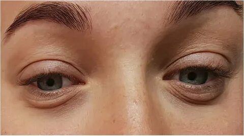 Eye can t