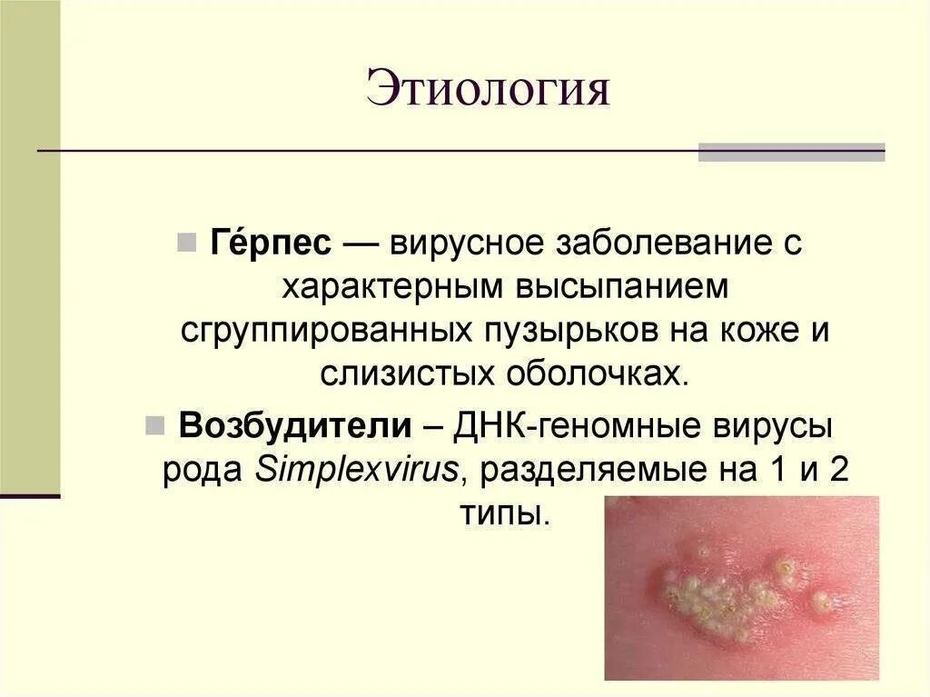 Часто герпес причины лечение. Факторы возникновения герпеса. Герпесвирусная инфекция типы. Вирус герпеса как передается. Часто герпес причины лечение.