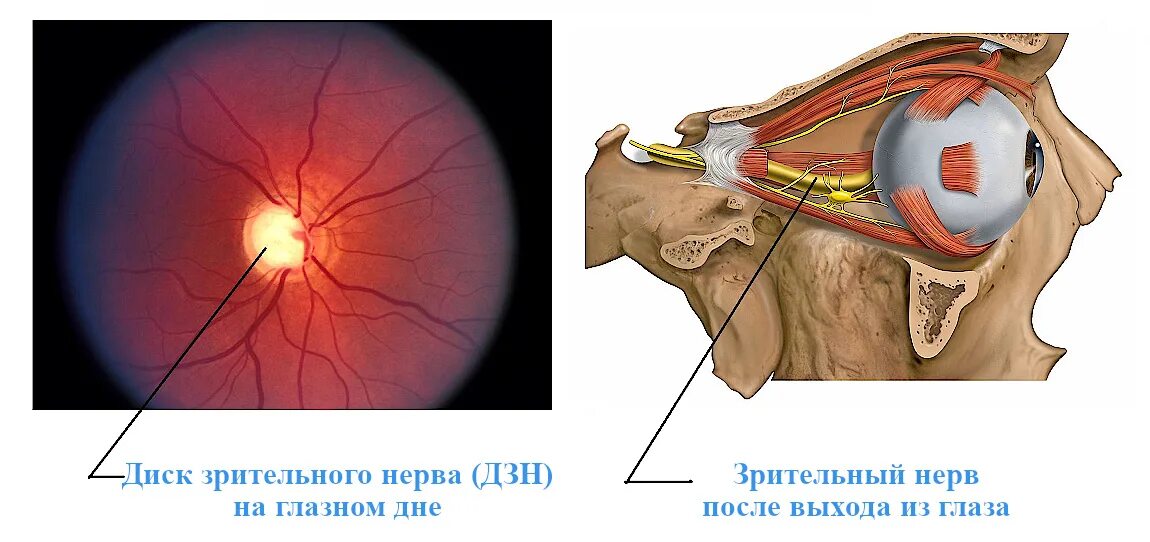 Зрительные нервы глазного яблока. Неврит зрительного нерва. Ретробульбарный неврит зрительного нерва. Синдром сдавления зрительного нерва. Фенестрации оболочки зрительного нерва.