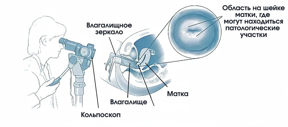 Как сделать матку