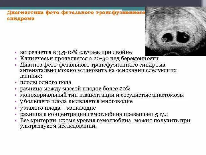 Фетофетальная гемотрансфузия. Патогенез фето-фетальной трансфузии. Синдром фето-фетальной гемотрансфузии. Фето фетальный синдром при двойне. Монохориальная диамниотическая многоплодная беременность.
