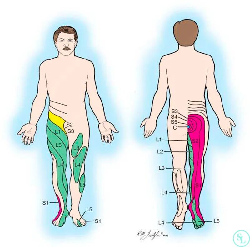 Иррадиация боли в ногу. Межпозвонковые диски l3-l4. Диски позвоночника l3 l4 l5. Позвоночный диск l5-s1 расположение. Грыжи дисков l4-l5.