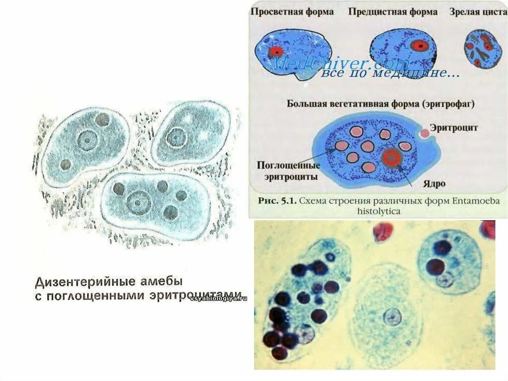 Клеточный цикл дизентерийной амебы. Стадии цикла развития дизентерийной амебы. Жизненные формы дизентерийной амебы. Просветная форма дизентерийной амебы. Жизненные формы амебы